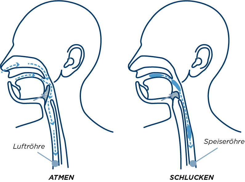 Eine medizinische Illustration von Atem- und Schluckvorgängen in der Luft- und Speiseröhre. Diese können bei einer Sialorrhoe beeinträchtigt sein.