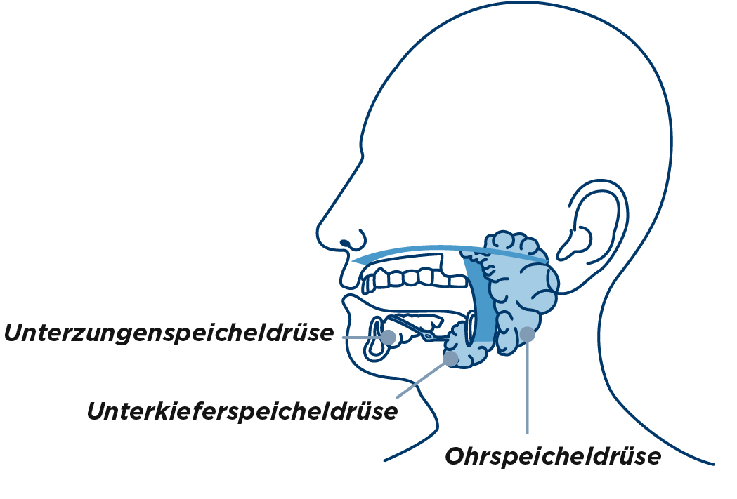 Eine medizinische Illustration der Speicheldrüsen im Halsbereich (Unterzungenspeicheldrüse, Unterkieferspeicheldrüse, Ohrspeicheldrüse), die bei Sialorrhoe übermäßig aktiv sein können.